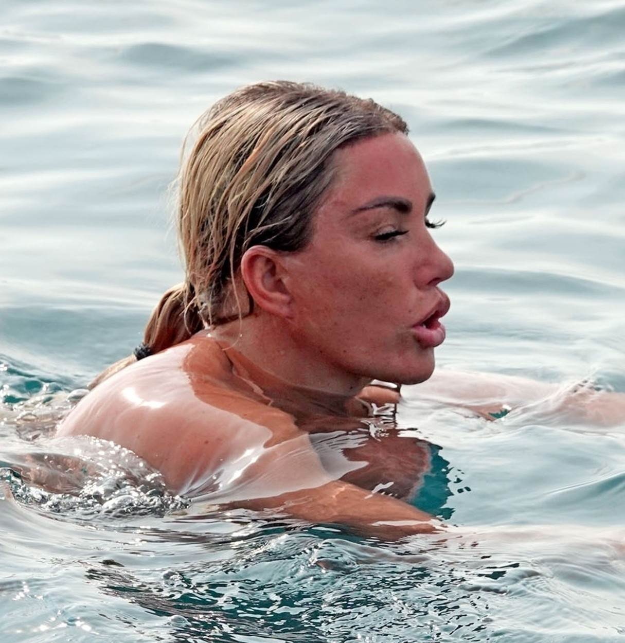 Lice Katie Price se raspada zbog operacija