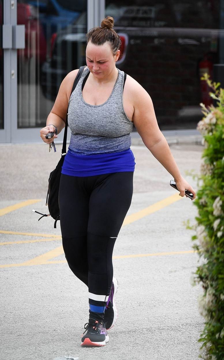 Kako izgleda koža voditeljice koja je smršavila 60 kilograma