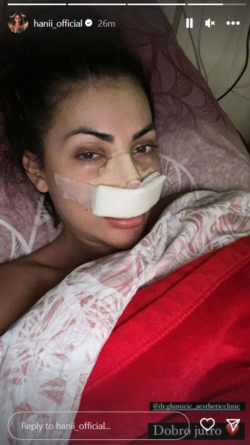 Hana Rodić operirala nos