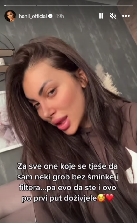 Hana Rodić bez šminke