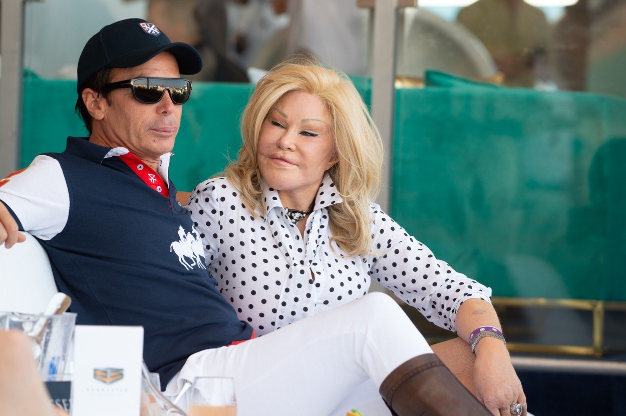 Kako je žena mačka izgledala prije operacija