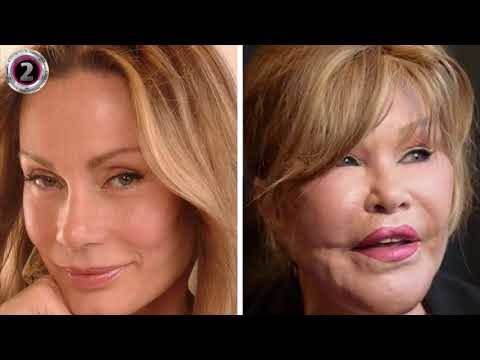 Kako je žena mačka izgledala prije operacija